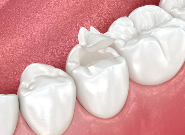 Oral Surgery in Dickson, TN